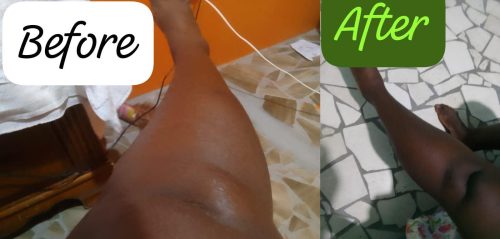 INFLAMMATION/SWELLING